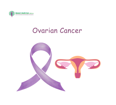 ovarian-cancer